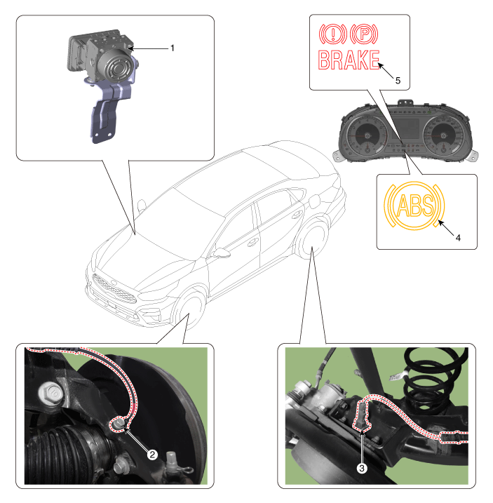 Проверьте esc kia